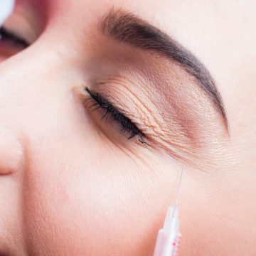 Post-Botox Care 101: Dos and Donts for Optimal Results
